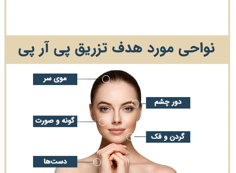 نواحی مورد هدف تزریق PRP