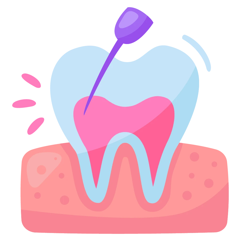 راهنمای جامع عصب‌کشی دندان