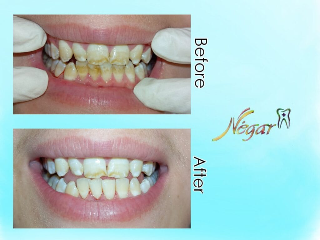 نمونه جرم گیری درمانگاه شبانه روزی نگار - 1