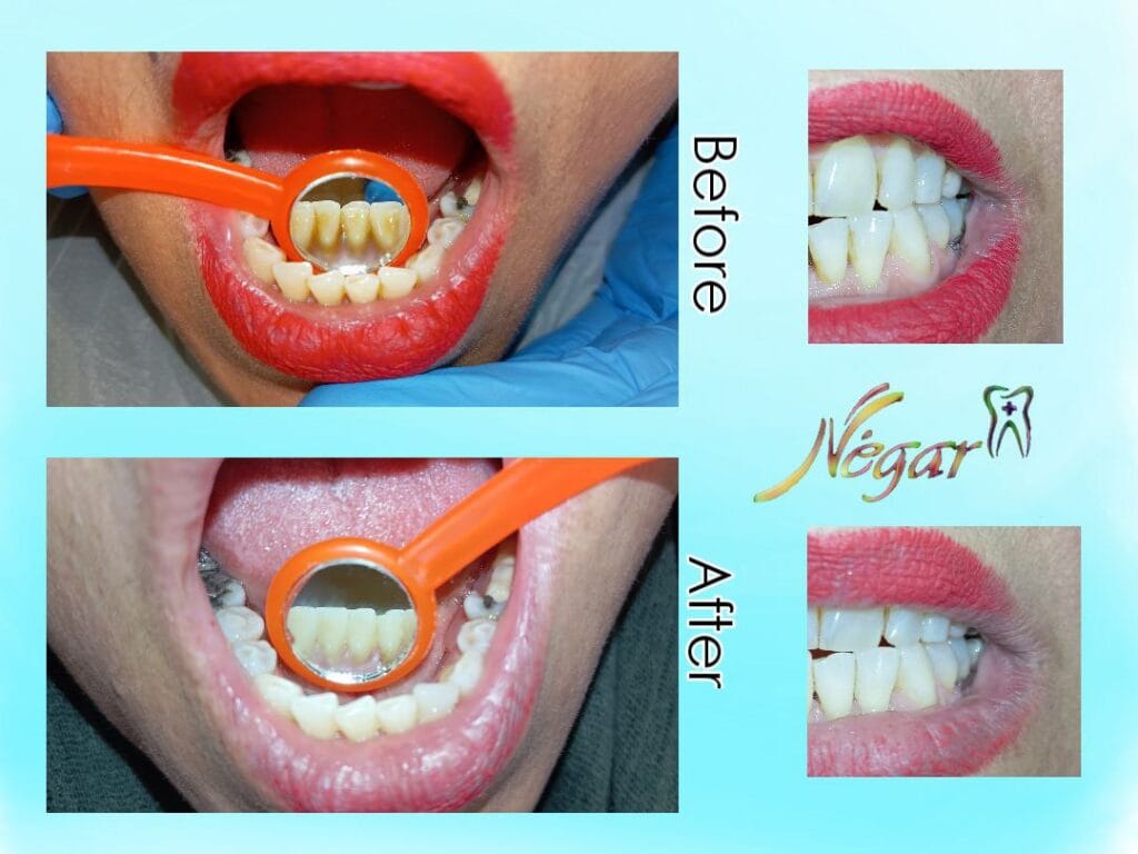 نمونه جرم گیری درمانگاه شبانه روزی نگار