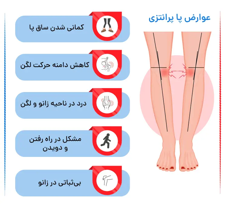 عوارض پای پرانتزی