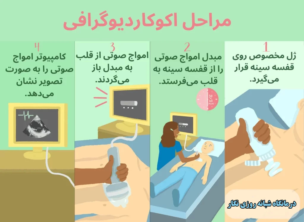 مراحل انجام اکوکاردیوگرافی در کلینیک