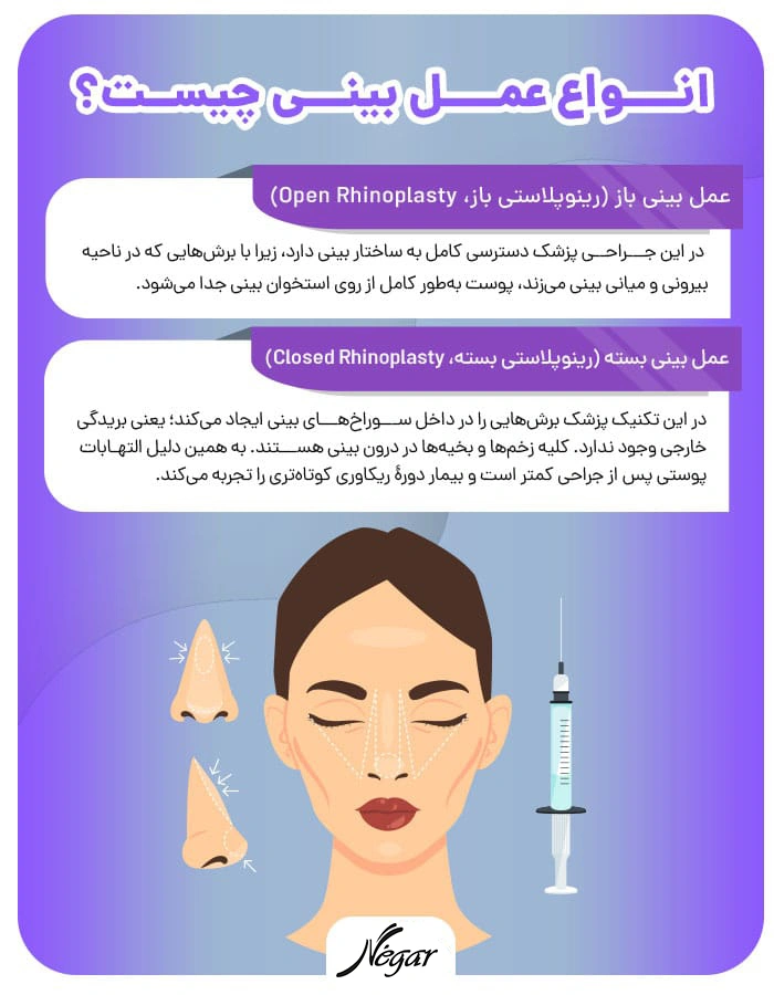 انواع عمل بینی