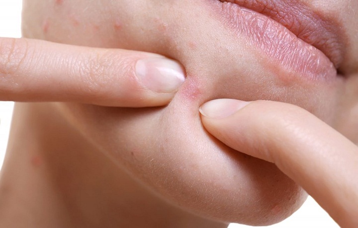 خودداری از دستکاری جوش‌ها