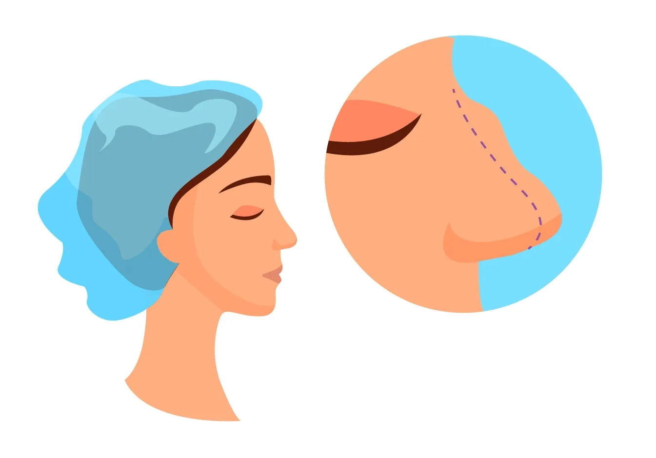 وکتور عمل بینی - 2