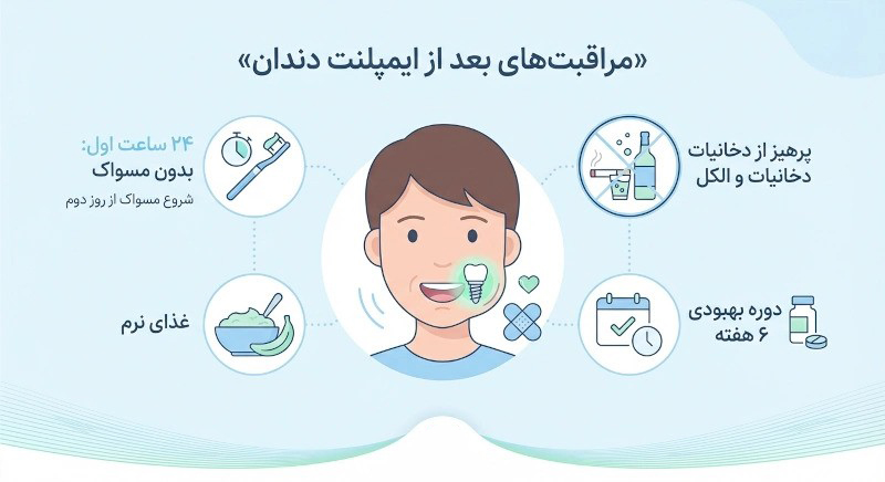 مراقبت‌ها و نکات مهم پس از کاشت ایمپلنت دندانی