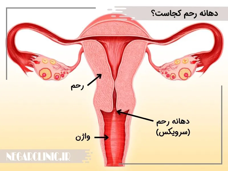 دهانه رحم
