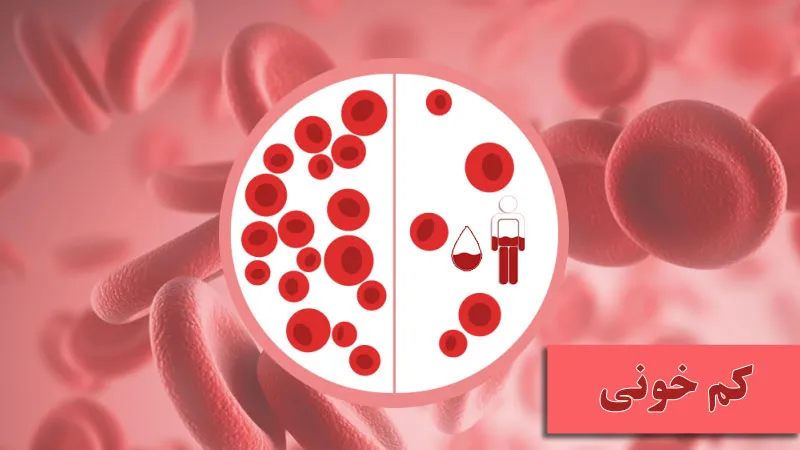 anemia